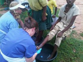 Treating Jiggers